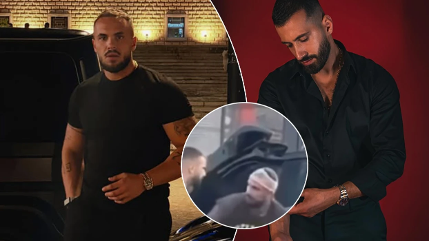 Është rrahur me Joz Markun? Edi Kuçi shfaqet me fashë në kokë në Tiranë 